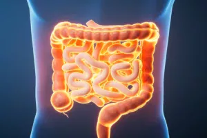 Saiba os sintomas do câncer colorretal, segundo coloproctologista