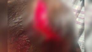Enteado é preso ao dar facada na cabeça de padrasto durante briga em Inocência