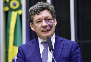 Após se aproveitar dos excessos, Lula agora propõe ‘limites’ ao STF para tentar não perder votos